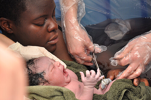 Baby-Day; water birth baby having umbilical cord cut